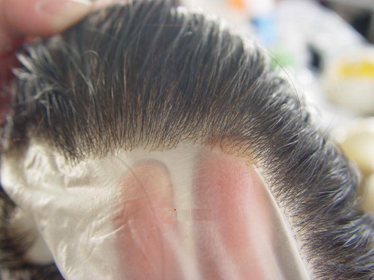 protez saç çeşitleri ultra thin skin hair systems